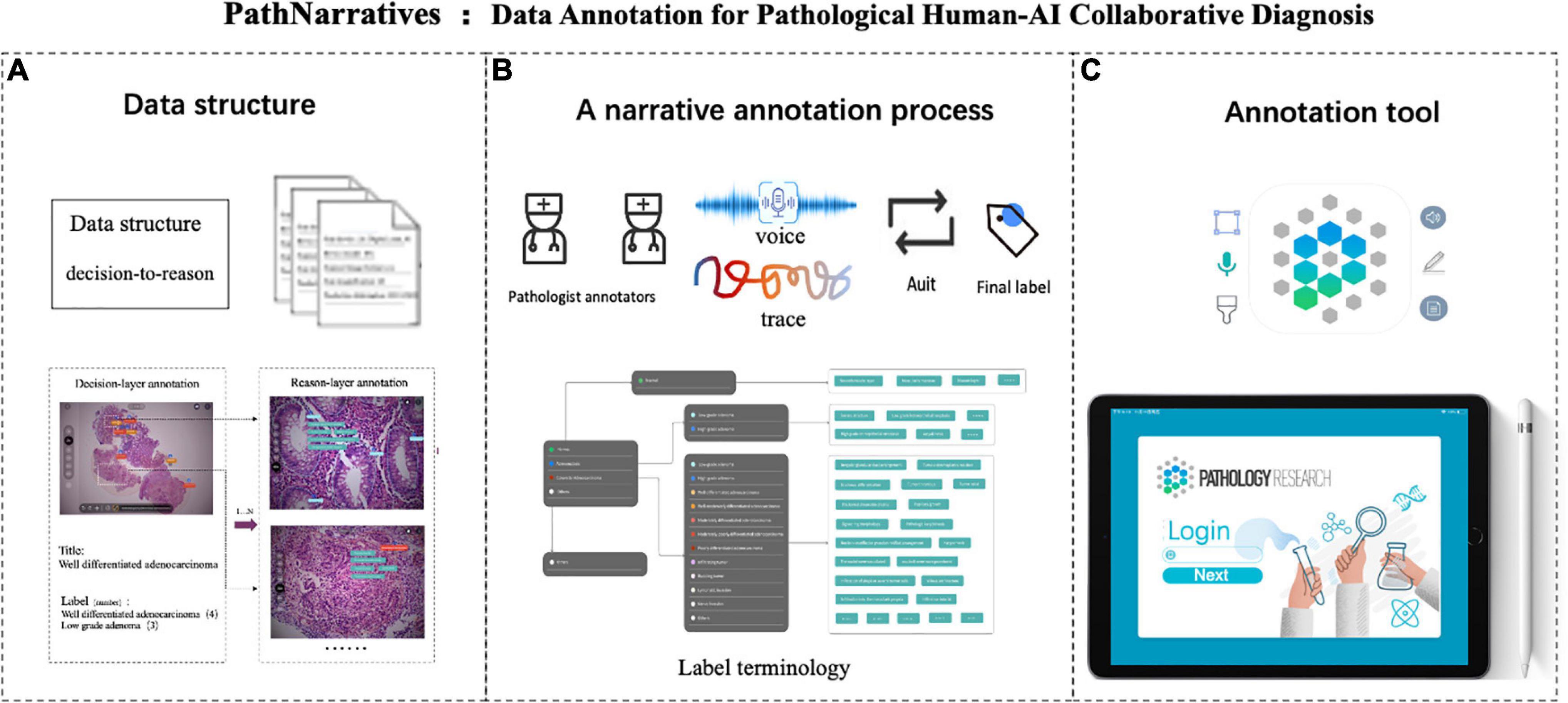 PathNarratives: Data annotation for pathological human-AI collaborative diagnosis